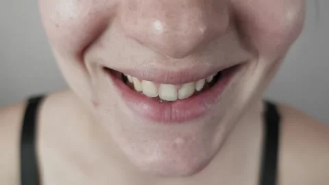 Womans Wide Smile Showing Teeth and Freckles Stock Footage 317907711