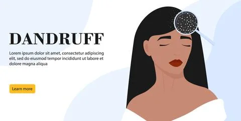 Women's dandruff problem on the head banner. Hair scalp problem. Fungal skin  Stock Illustration