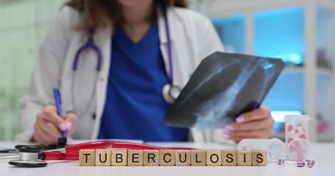 Wooden blocks spell Tuberculosis while doctor checks lung x-ray Stock Footage 314125246
