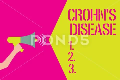 Word writing text Crohn s is Disease. Business concept for inflammatory disease Stock Illustration