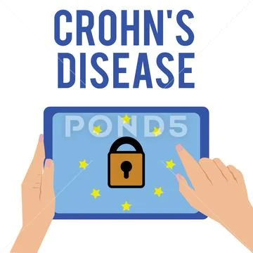Word writing text Crohn s is Disease. Business concept for inflammatory disease Stock Illustration