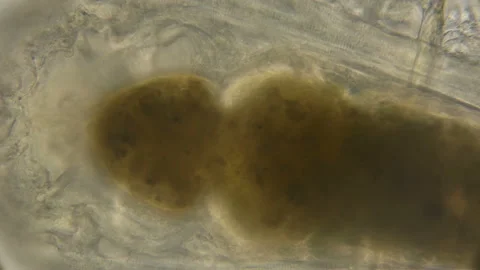 The work and structure of the internal organs of the Cyclops under the Vidéo 89168240