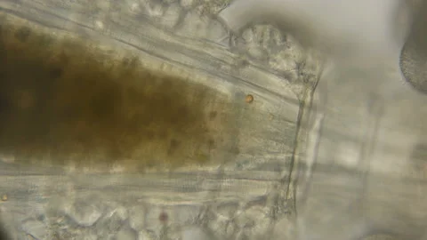 The work and structure of the internal organs of the Cyclops under the Vidéo 89174190