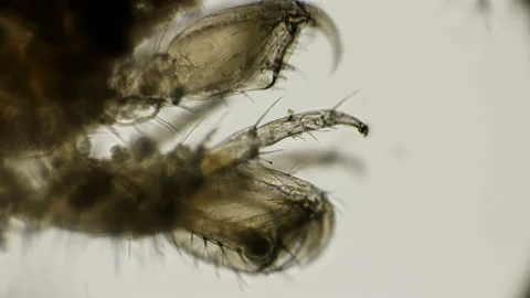 The work of the front leg of Gammarus - like hooks under a microscope Stock Footage 92708143