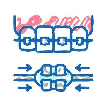 Work process tooth braces icon doodle illustration Illustrazione stock