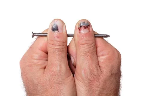 Workers fingers 库存照片