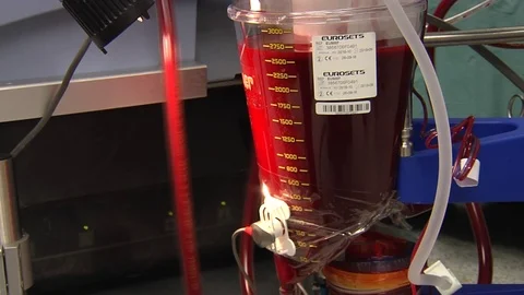 Working Heart-Lung Bypass Machine.  Surgery in modern operating room Stock-Footage 72494424