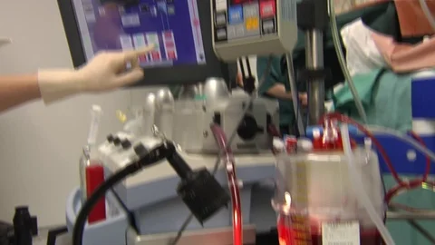 Working Heart-Lung Bypass Machine.  Surgery in modern operating room Stock Footage 72494445
