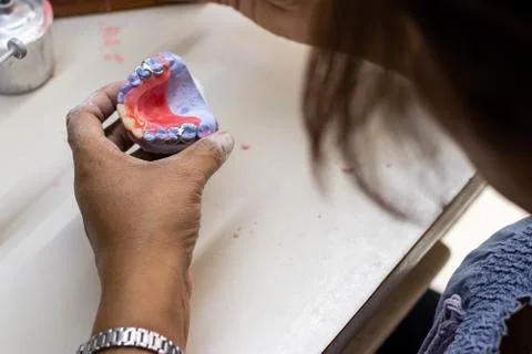 Working in the inside of the prosthetic with the wax Stock Photos