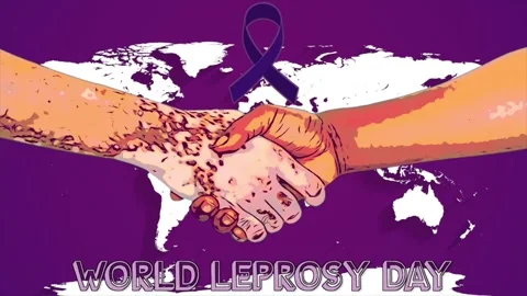 World leprosy day animation Stock Footage 325619416