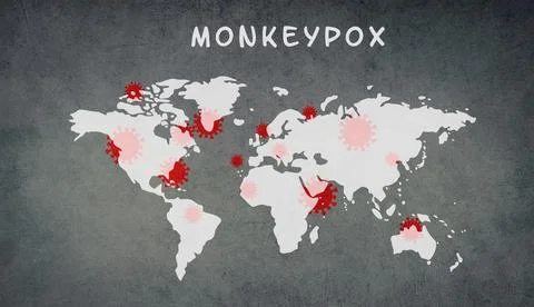 World map, monkeypox is standing on the textured background, outbreak of the Stockfoto's