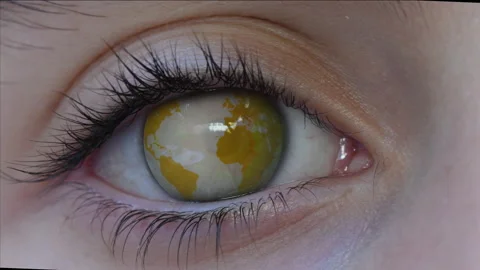 World spinning in one eye Video stock 133816437