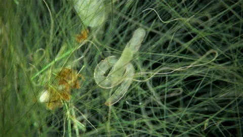Worm Aeolosoma sp. under a microscope, Aeolosomatidae family. Stock Footage 156102570