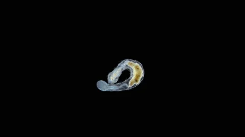 Worm Aeolosoma sp. under a microscope, Aeolosomatidae family. Stock Footage 158304290