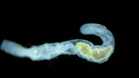 Worm Aeolosoma sp. under a microscope, Aeolosomatidae. Stock Footage 236812185