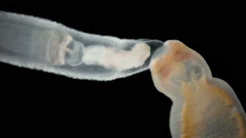 Worm Arctostemma arcticum under the microscope, phylum Nemertea Video stock 219543627