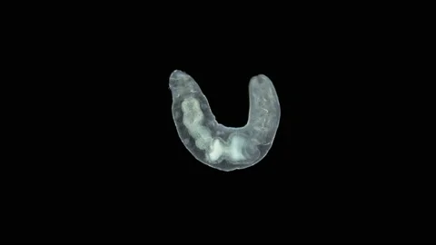 Worm Chaetogaster sp. under the microscope, Class Oligochaeta. Stock Footage 160274605