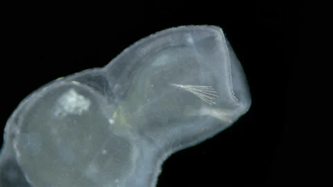Worm Chaetogaster sp. under the microscope, Class Oligochaeta. Lives in fresh Stock Footage 195157576