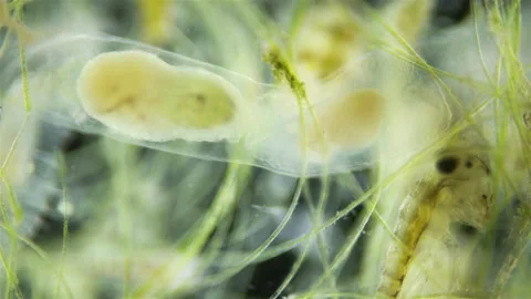 Worm Chaetogaster sp. under the microscope, Class Oligochaeta. Stock Footage 237160485