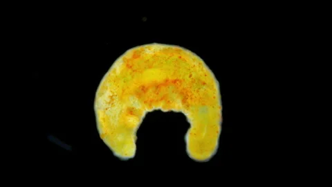 Worm Dinophilus taeniatus under a microscope, family Dinophilidae Stock Footage 253849207
