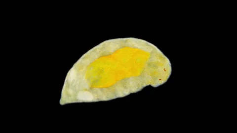 Worm Dinophilus taeniatus under a microscope, family Dinophilidae. White Sea Stock Footage 327267768