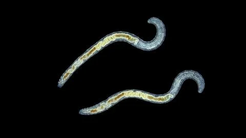 Worm Enchytraeus sp. under the microscope, Oligochaeta, order Haplotaxida. .. Stock Photos