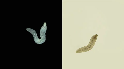 Worm family Microstomidae under microscope, possibly Alaurina sp Stock Footage 138688456
