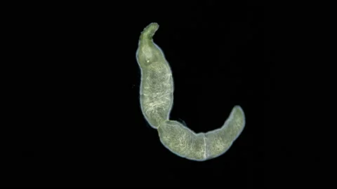 Worm family Microstomidae under microscope, possibly Alaurina sp Microstomum sp Stock Footage 232226832