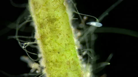 A worm (flatworm) of Dalyelliidae family under a microscope, Rhabdocoela Stock Footage 236282249