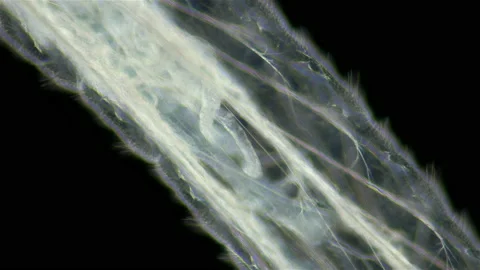 Worm-like larva of a fly midge insect of the order Diptera under a microscope Stock Footage 158623883