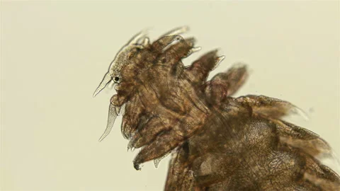 Worm Lopadorrhynchus sp. under a microscope, the family Lopadorrhynchidae, type Stock Footage 125529083