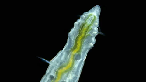 Worm Manayunkia baicalensis under a microscope, of the family Fabriciidae. Stock Footage 141574283