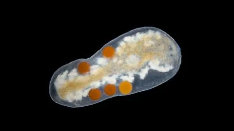 Worm Mesostoma sp. under a microscope, family Typhloplanidae, Order Rhabdocoe Fotos Stock