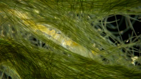 Worm Nais sp. under a microscope, the Tubificidae family, a subclass of Stock Footage 130097497