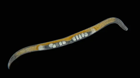 Worm Nematoda under the microscope, Phylum Protostomia Stock Footage 139346600