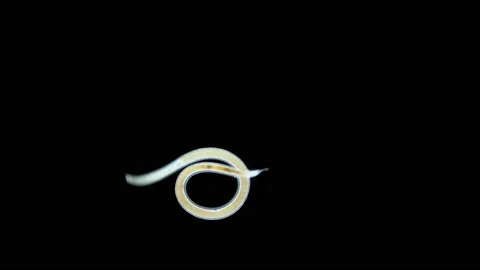 Worm Nematoda under microscope, Phylum Protostomia, free-living nematodes Stock Footage 166844129