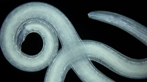 Worm Nematoda under microscope, Phylum Protostomia, free-living nematodes Stock Footage 252371427
