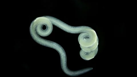 Worm Nematoda under microscope, Phylum Protostomia Stock Footage 252741125