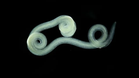Worm Nematoda under microscope, Phylum Protostomia Stock Footage 252873637