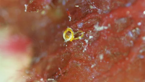 Worm Nematoda under microscope, Phylum Protostomia Stock Footage 295981086