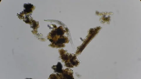 Worm nematode under microscope, magn 200x Видео 45591723