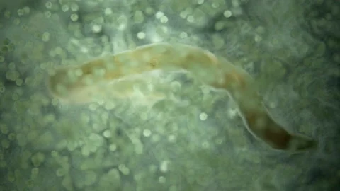 Worm Nemertea Lineus ruber under a microscope, family Lineidae.Climbed into Stock Footage 232099972