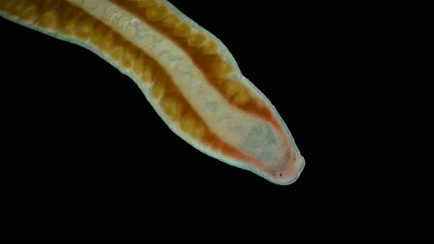 Worm Nemertea Prostoma sp. under the microscope, of the Tetrastemmatidae family. Stock Footage 147740479