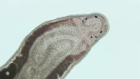 Worm Nemertea Prostoma sp. under the microscope, of the Tetrastemmatidae family Stock Footage 158872113