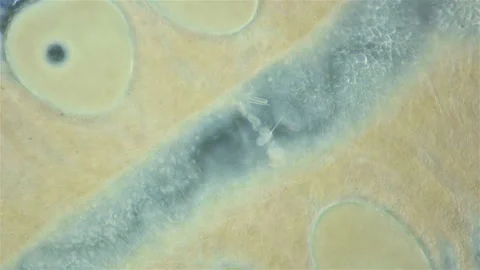 Worm Nemertea Prostoma sp. under the microscope, of the Tetrastemmatidae family Stock Footage 158904628