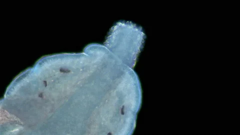 Worm Nemertea Prostoma sp. under the microscope, of the Tetrastemmatidae family Stock Footage 158904749