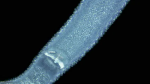Worm Nemertea Prostoma sp. under microscope, of  Tetrastemmatidae family Stock Footage 158904880