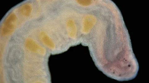 Worm Nemertea Prostoma sp. under the microscope, of the Tetrastemmatidae family Stock Footage 160729625