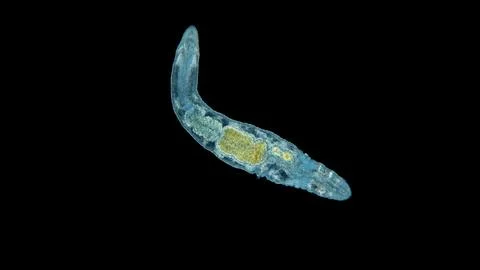 Worm Oligochaeta under the microscope. Feeds on algae, microorganisms and dea Stock Photos