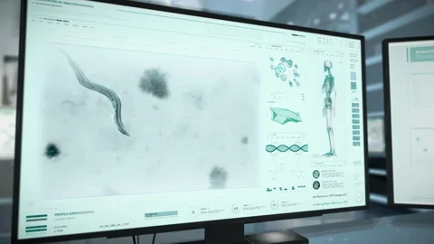 Worm Parasite Inside Human Organism Analysed By Modern Microscope Equipment Video stock 208403655